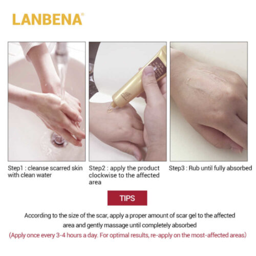 LANBENA Acne Scar Removal Cream Skin Repair Face Cream Acne Spots Acne Treatment Blackhead Whitening Cream